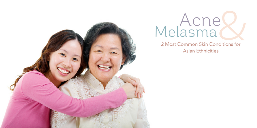 Acne and Melasma: Two Most Common Skin Conditions for Asian Ethnicities