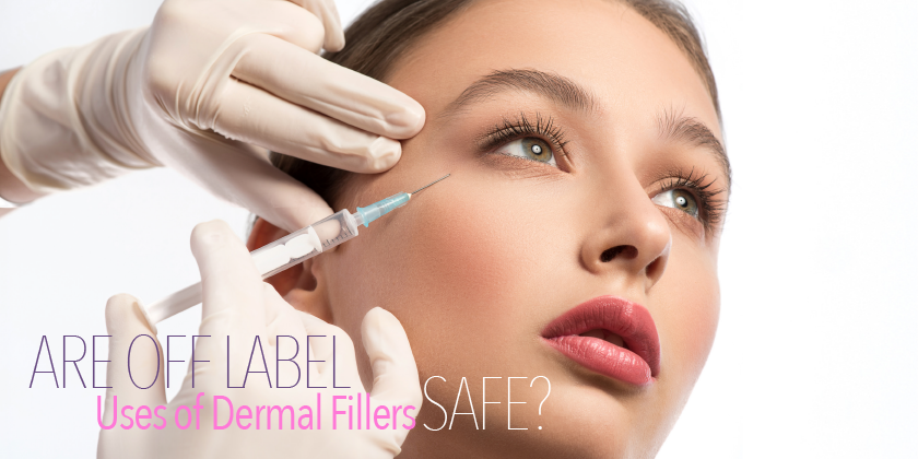 Are “off label” Uses of Dermal Fillers Safe?