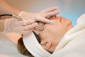 microdermabrasion treatment derma health