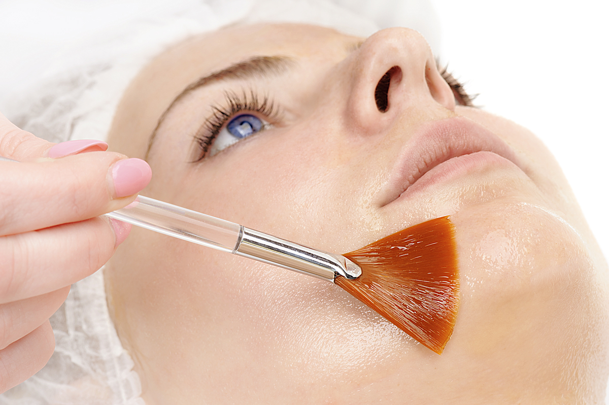 vi facial peel for skin discoloration