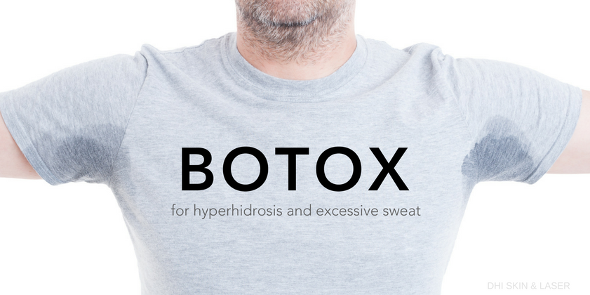 Image result for botox underarms