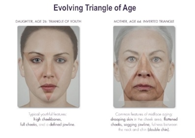 facial aging and facial fillers