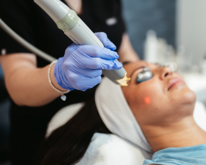 Laser Genesis for Skin Tone