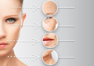 where facial filler can be used