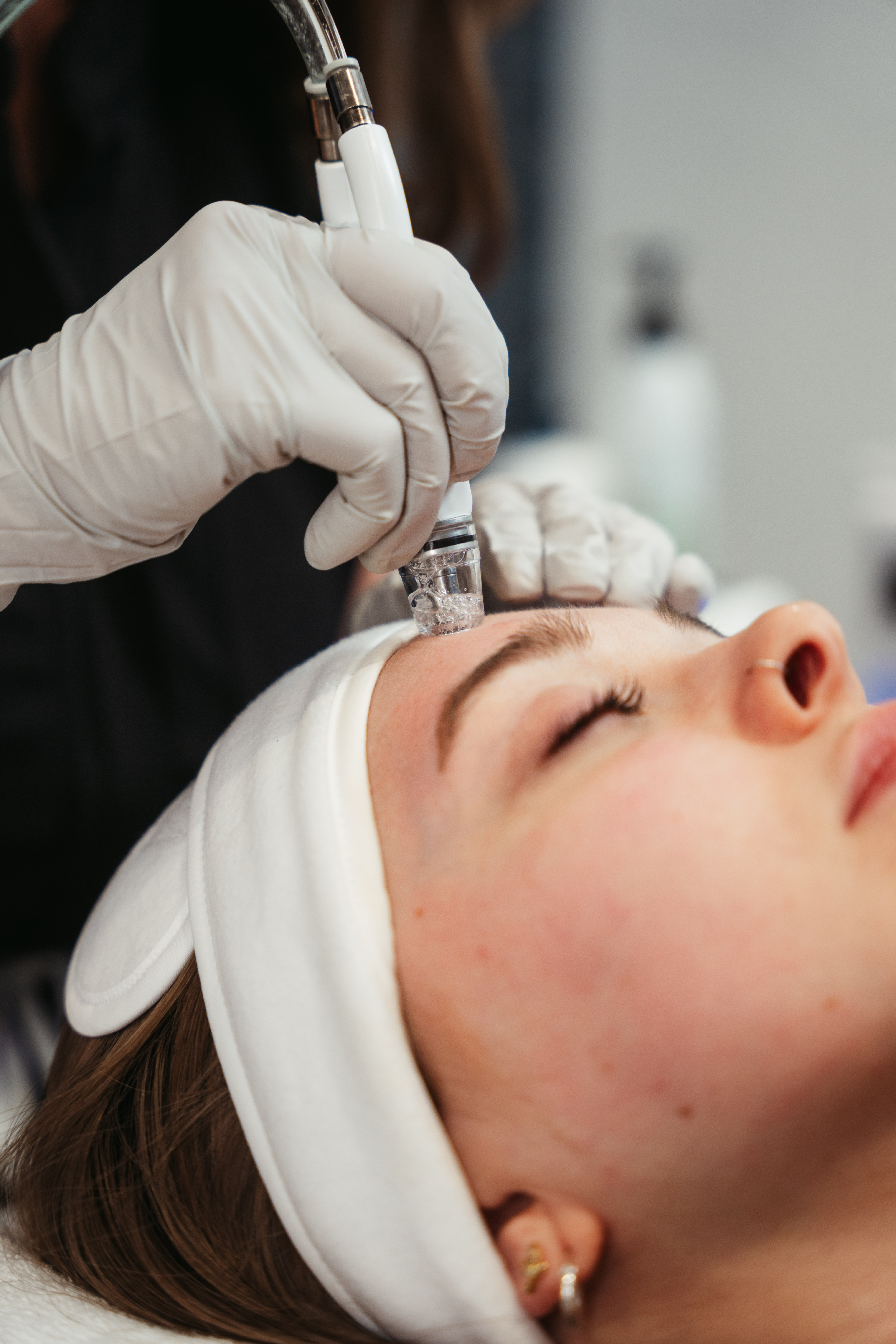 DiamondGlow Treatment