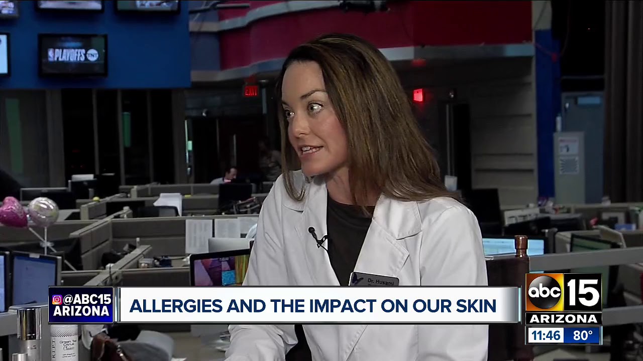 Allergies & The Impact On Your Skin