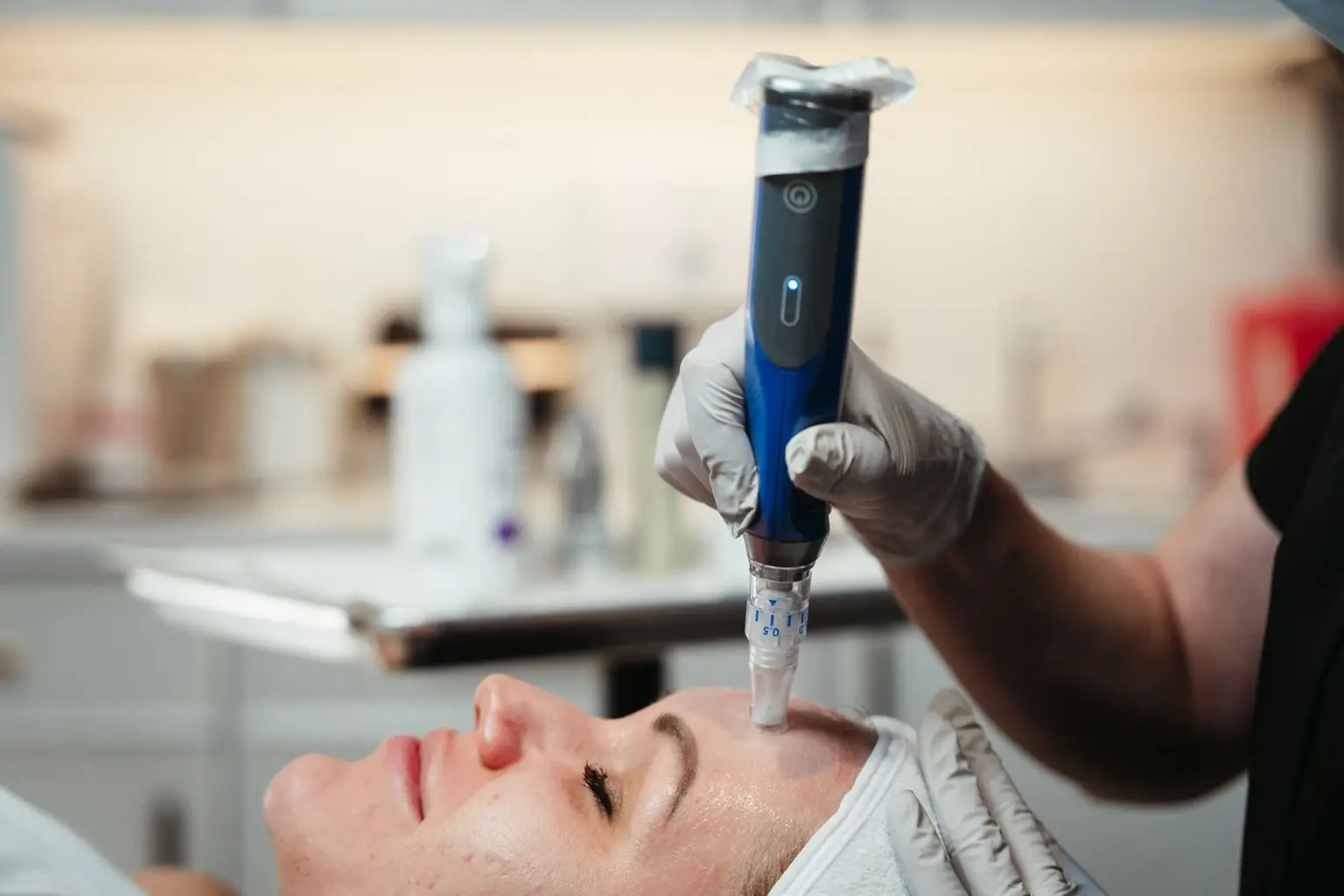Microneedling & Plasma Pen