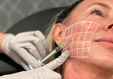 big-SkinVive Injectables Graphic